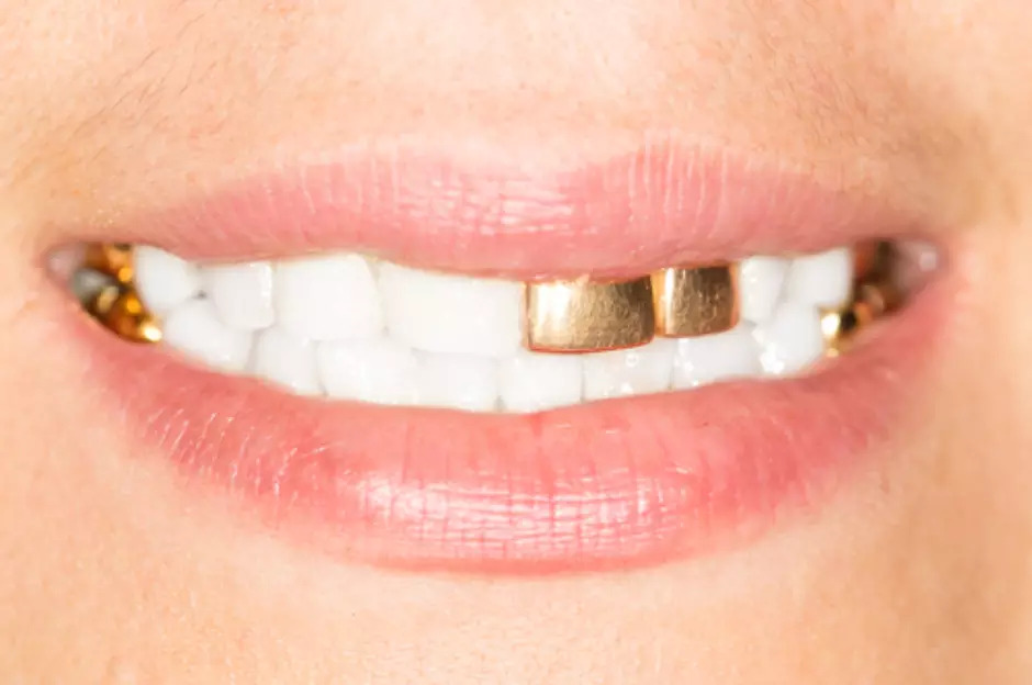 Mulher ameaça matar vizinha para roubar dentes de ouro é e presa